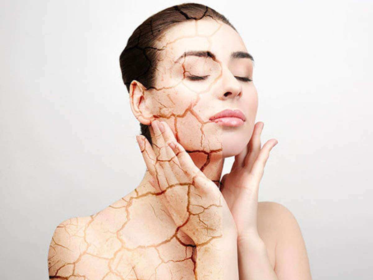 Home Remedies to treat Dry skin !!